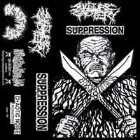 Sulfuric Cautery / Suppression - Split