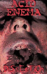 Acid Enema - Dissection