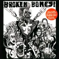 Broken Bones - Dem Bones