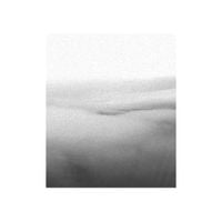 Lump - Strain Field