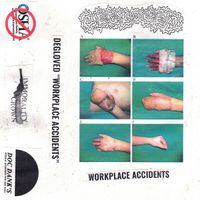 Degloved - Workplace Accidents