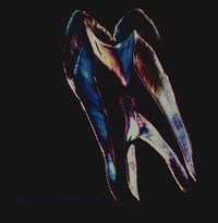 H&auml;stk&ouml;ttskandalen - Spacegirls