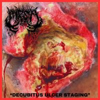 MRSA - Decubitus Ulcer Staging