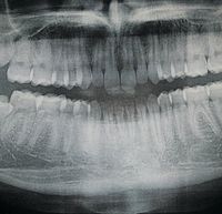 3D3N - 3D3N