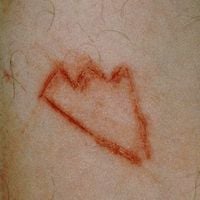 XXXTENTACION - King of the Dead