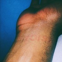Miles From Kinshasa - LIMBO