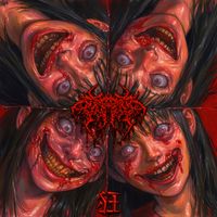Hypergammaglobulinemia - 狂 [Madness]