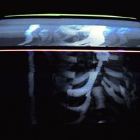 BONES - Carcass (СКЕЛЕТ)