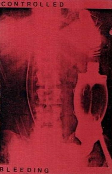 Controlled Bleeding - Controlled Bleeding