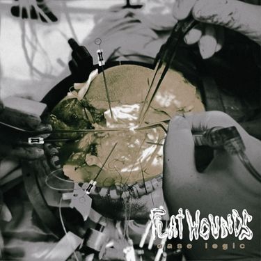 Flatwounds - case logic