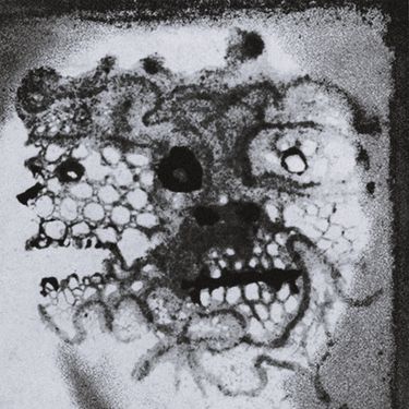 Mallthansis - Cotard
