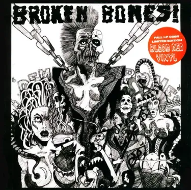 Broken Bones - Dem Bones