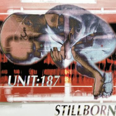 Unit:187 - Stillborn