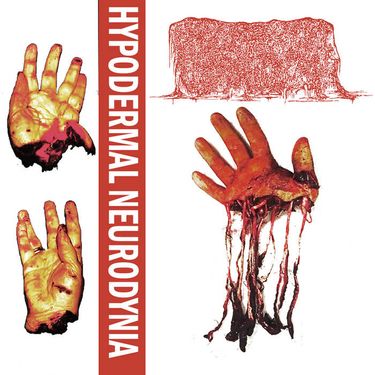 HYPODERMAL NEURODYNIA - HYPODERMAL NEURODYNIA