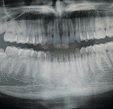 3D3N - 3D3N